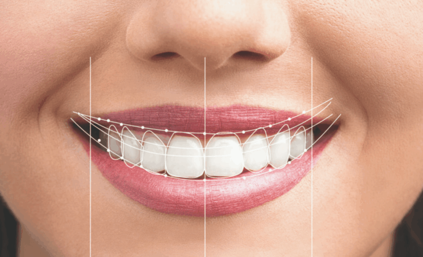 Diş Kaybı Neden Ciddiye Alınmalı? 1 Diş Eksikliği Nelere Yol Açar?