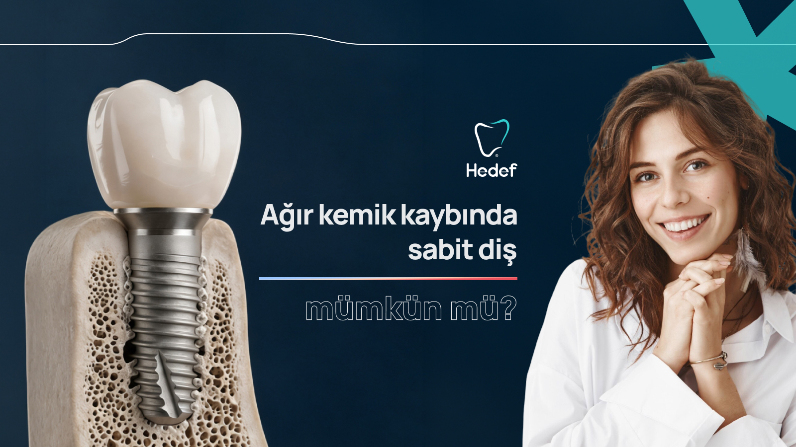 Ağır Kemik Kaybında Sabit Diş Mümkün mü?