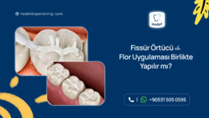 fissür örtücü