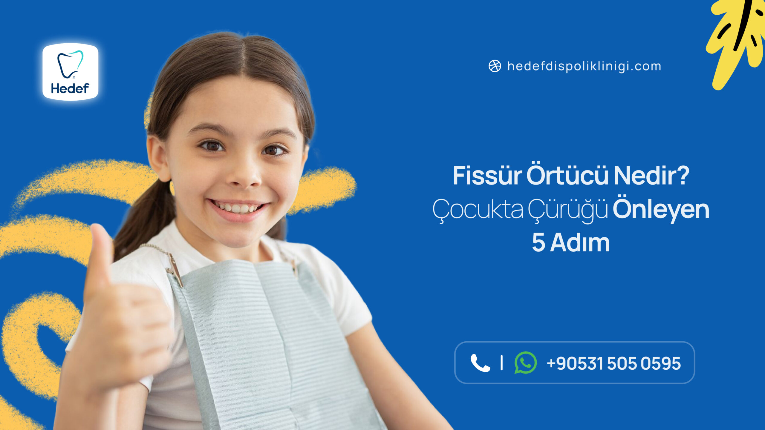 Fissür Örtücü Nedir? Çocukta Çürüğü Önleyen 5 Adım