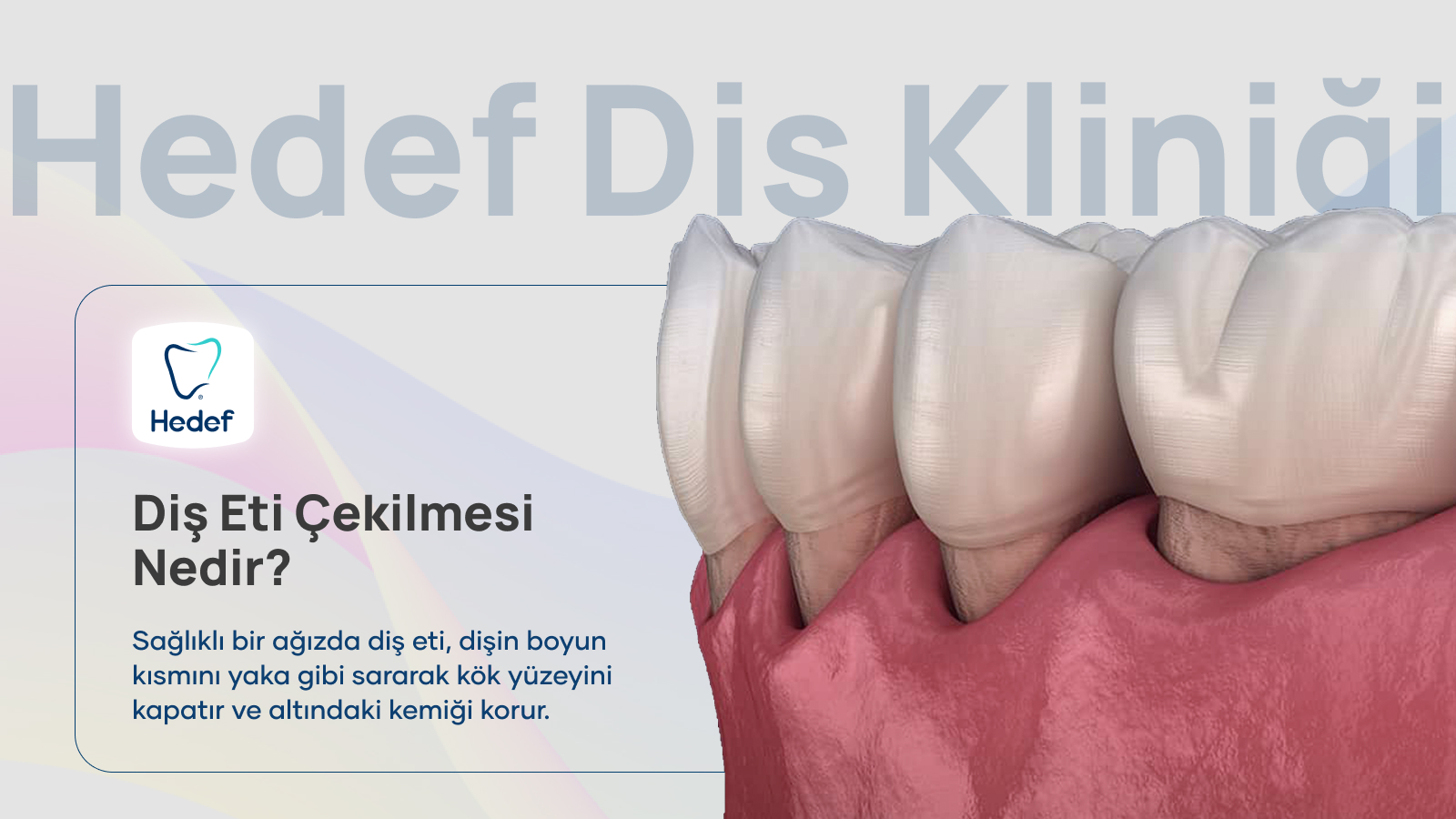 Diş Eti Çekilmesi: Nedenleri ve 7 Tedavi Seçeneği